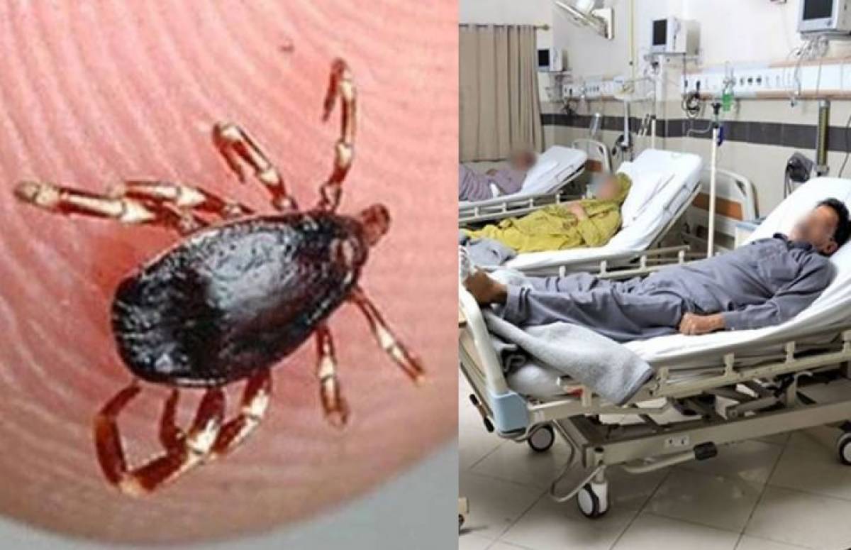 Congo Hemorrhagic Fever Reported in KP