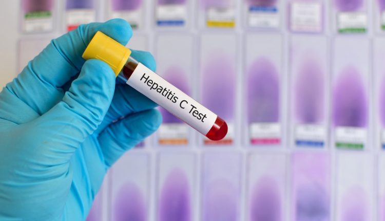 Hepatitis C Cases Pakistan