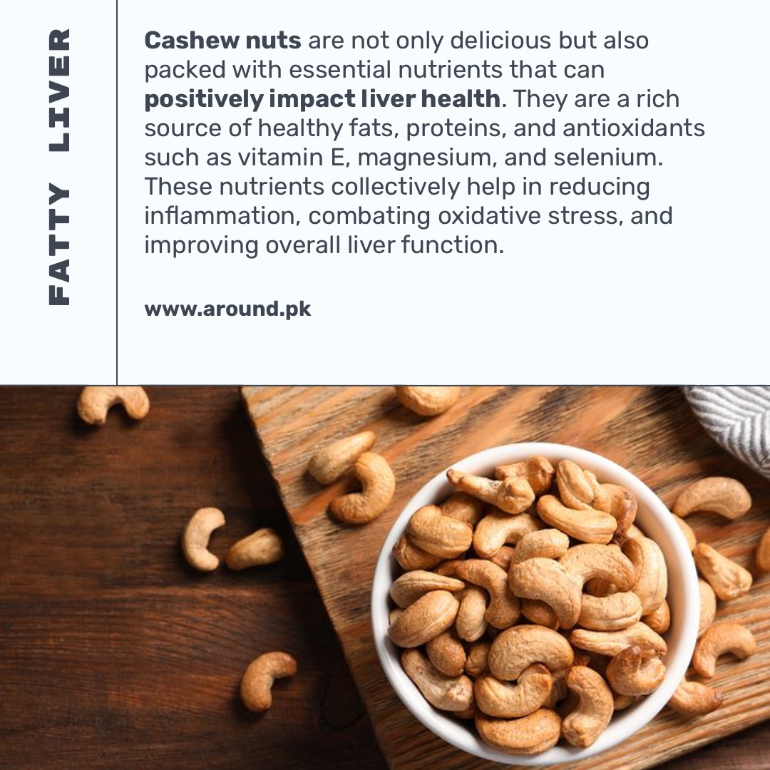 Are Cashew Nuts Good for Fatty Liver?