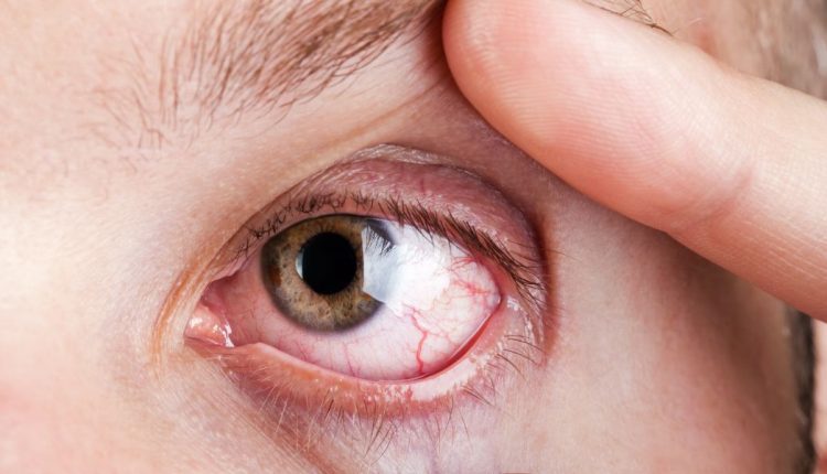 Low-Quality Injections Impact Vision of 40 Diabetic Patients in Lahore